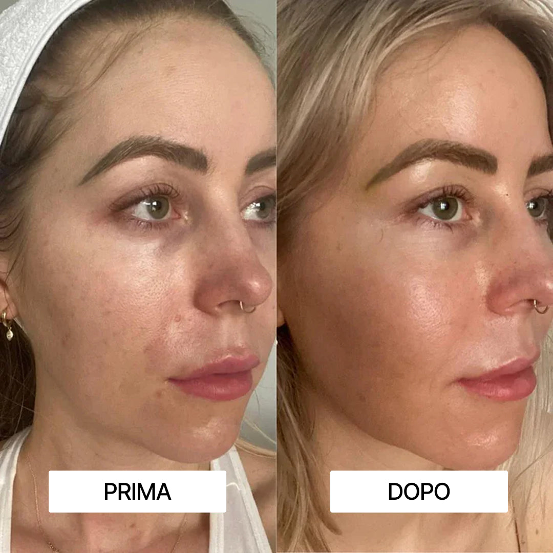 Rituale Anti-Rughe Oro 24K + Idratazione al Collagene