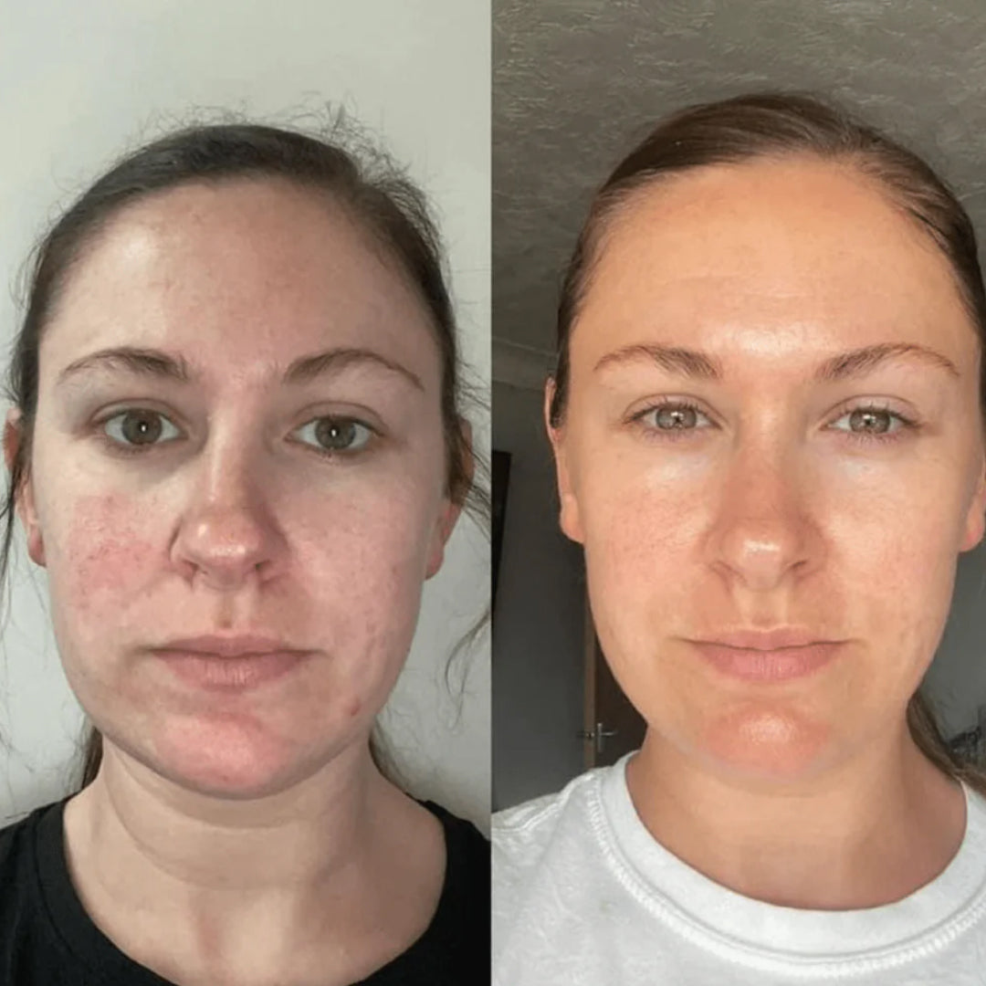 Rituale Anti-Rughe Oro 24K + Idratazione al Collagene