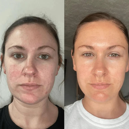 Rituale Anti-Rughe Oro 24K + Idratazione al Collagene