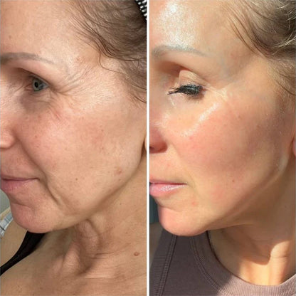 Rituale Anti-Rughe Oro 24K + Idratazione al Collagene